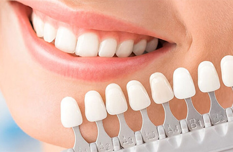 Facetas e Lentes de Contato - Clínica Renovi Odontologia